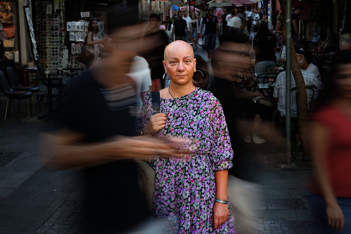 Alopesiyle 23 yıllık mücadelesini toplumsal farkındalığa dönüştürdü