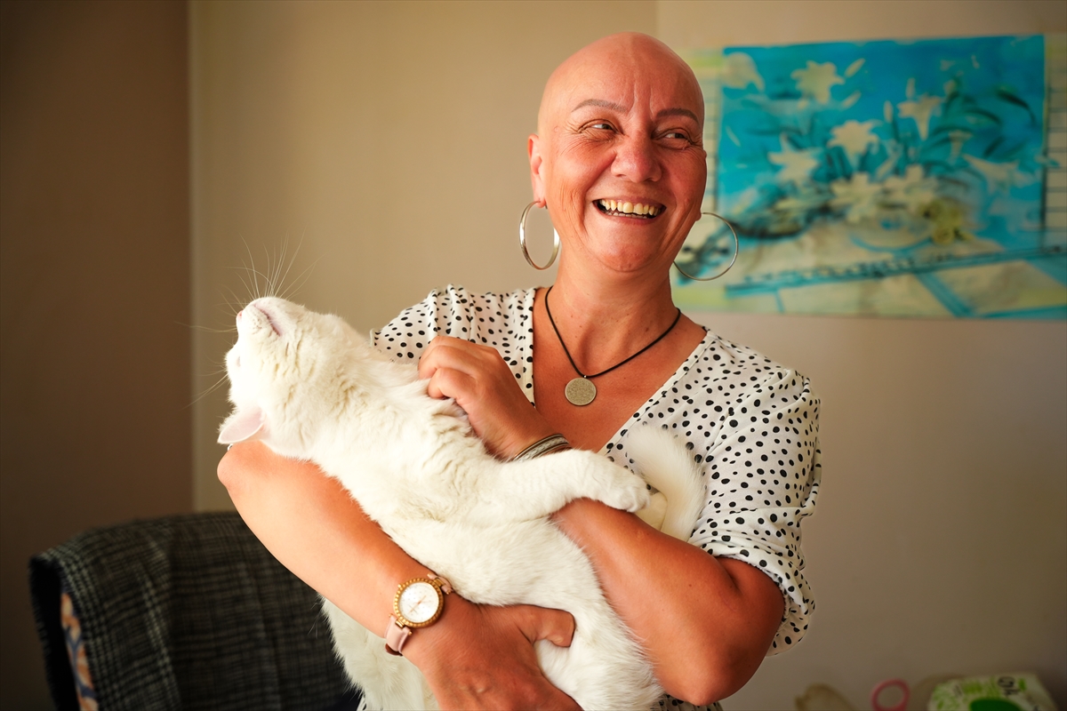 Alopesiyle 23 yıllık mücadelesini toplumsal farkındalığa dönüştürdü