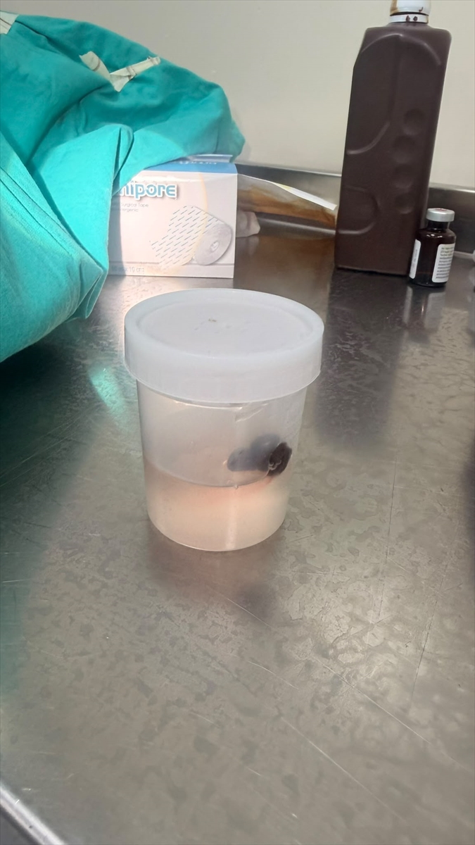 Siirt'te boğazında sülük olan çocuk hastaneden taburcu edildi