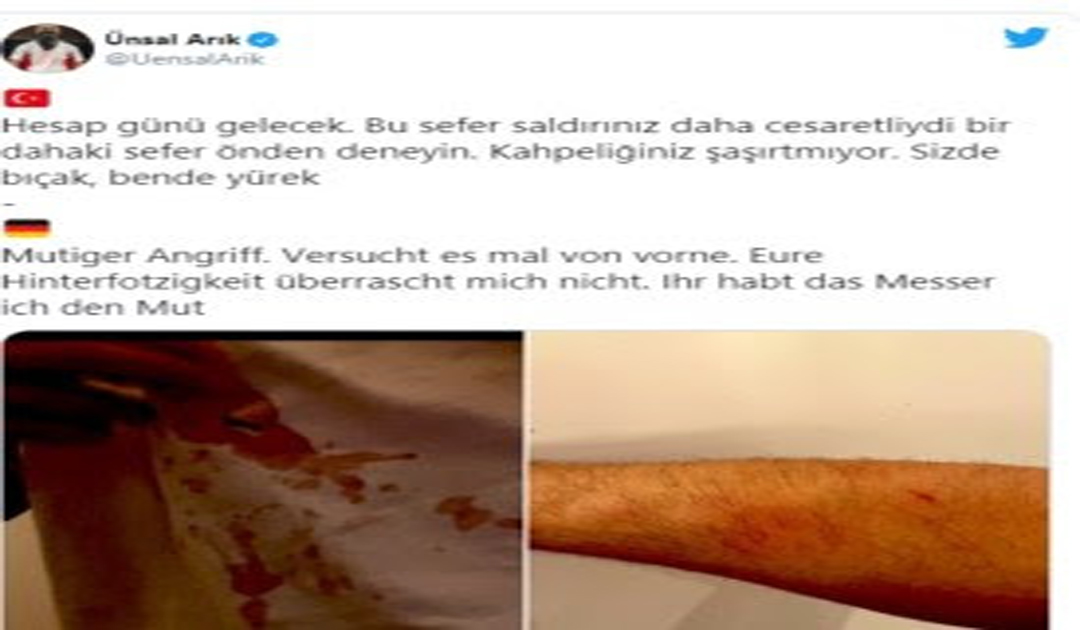 Boksör Ünsal Arık’a bıçaklı saldırı düzenlenmiş