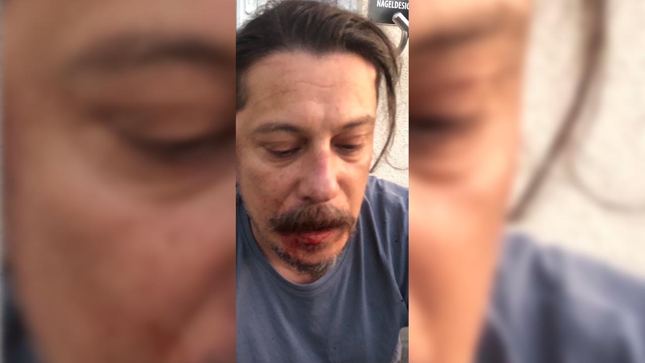“Avrupa’da infaz timi” iddiası: Alman hükümetinden açıklama bekliyoruz!