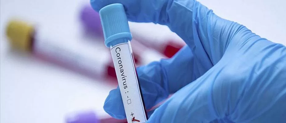 DSÖ'den Kovid-19'un yeni varyantları karşısında ‘daha fazla test’ çağrısı