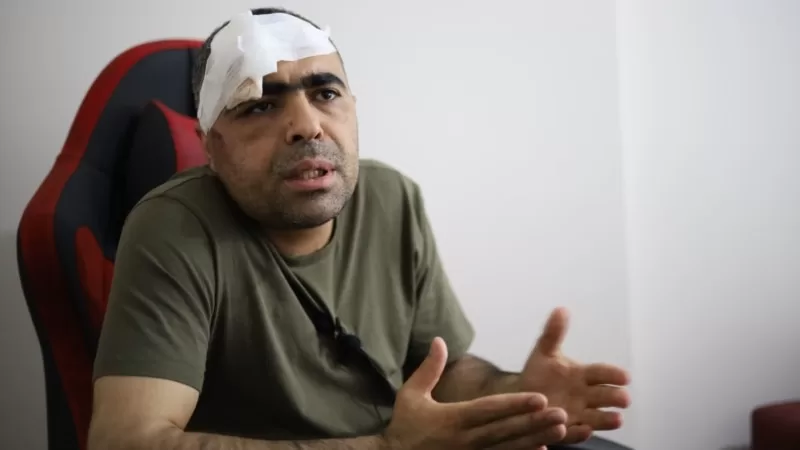 Gazeteci Sinan Aygül’e saldıran korumalar hakkında ‘basit yaralama’ davası