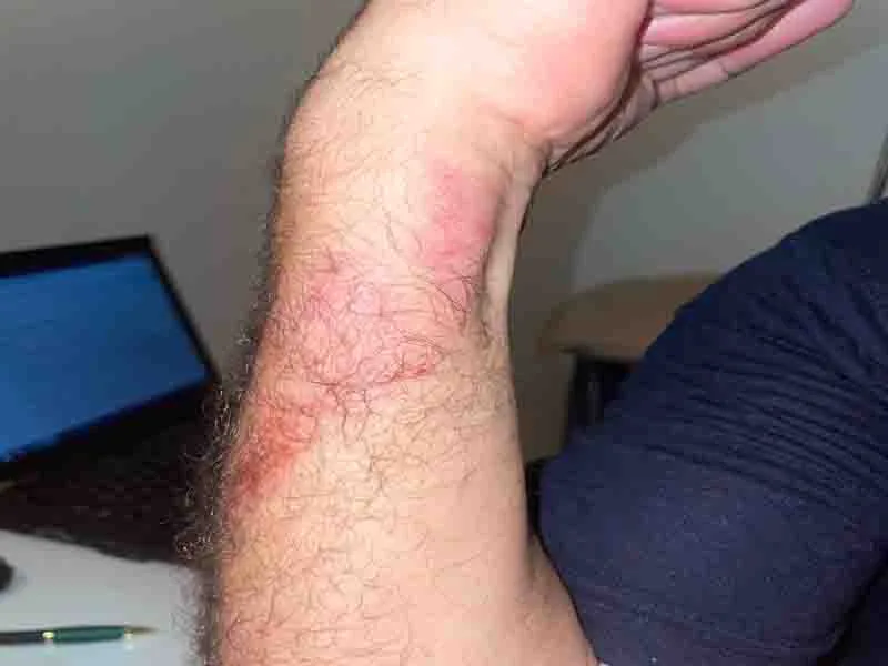 Saldırıya uğradı, ölümden döndü, saldırgan serbest bırakıldı